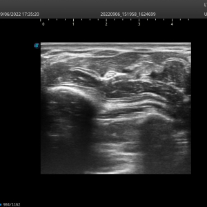 20220906 173521 Vascular 248
