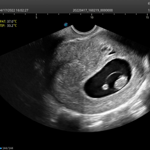 6V1 Early Pregnancy 3